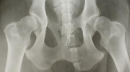 Hip x-ray